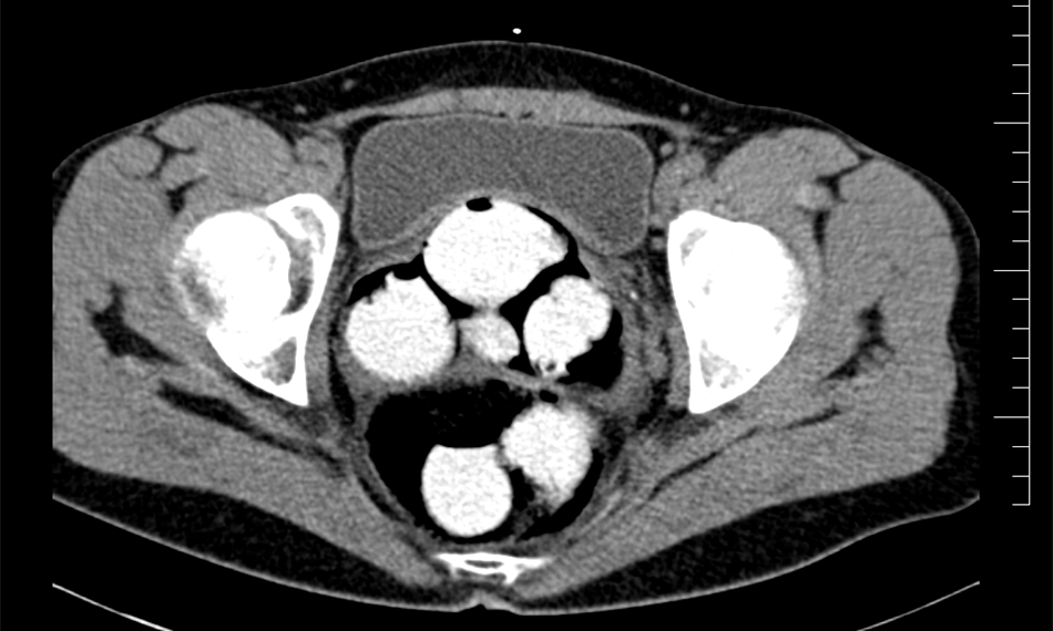 2017-10-4-947foto 3.png